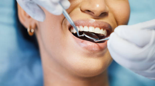 Best Dentist for Tooth Abscess  in Groveland, ID
